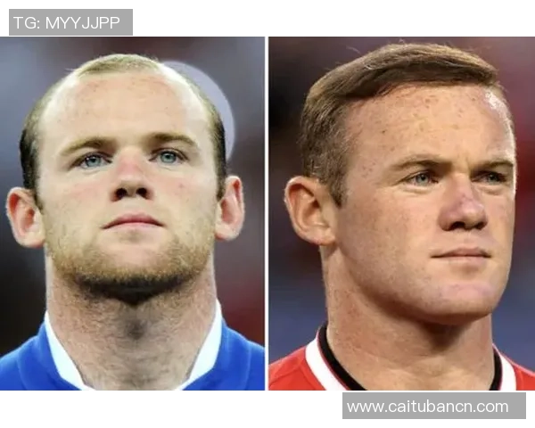 足球明星整容真相揭秘他们的外貌变化背后的故事